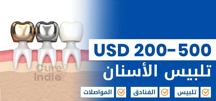 أسعار تلبيس الأسنان